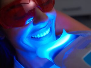Close-up of a person receiving the best teeth whitening for sensitive teeth treatment with blue light.