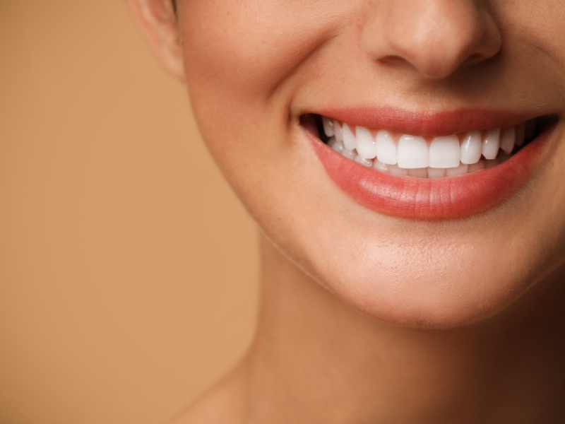 Porcelain veneer treatment