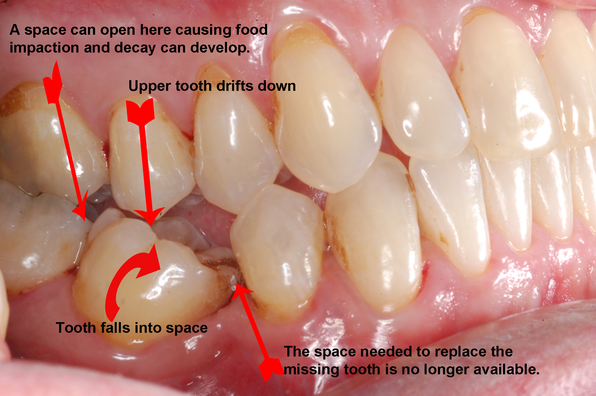 do-you-have-integrity-read-below-dental-implants-dentist